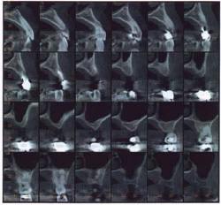 Ct image